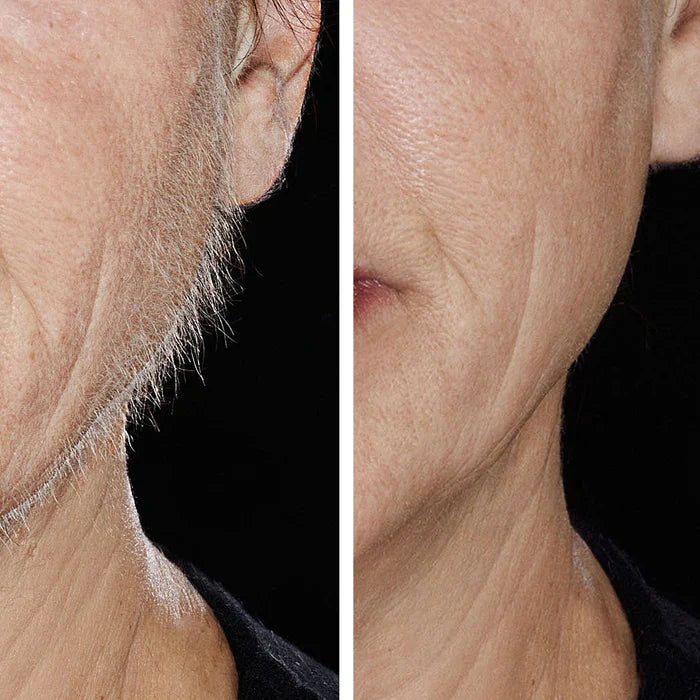 HOLLYWOOD SMOOTHER SONIC DERMAPLANING DEVICE